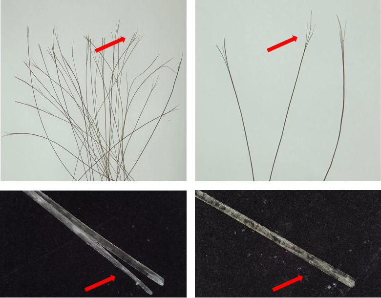 Scalp,health,Cosmetc,Efficacy,Evaluation