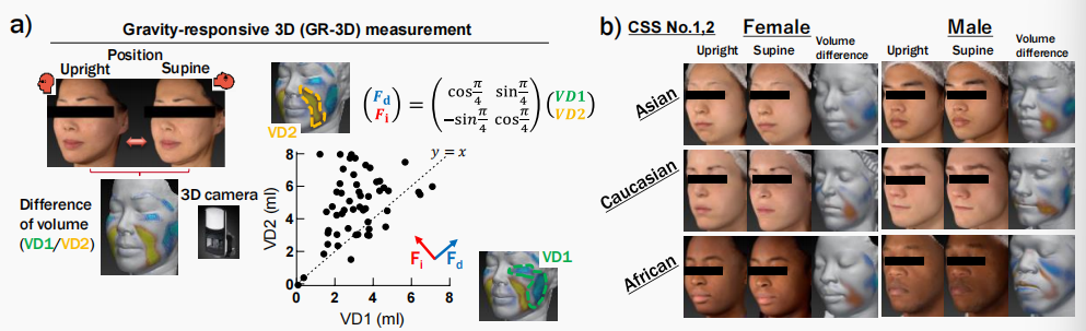 CIRS功效評(píng)價(jià),技術(shù)實(shí)踐,下垂,水腫,定量評(píng)估