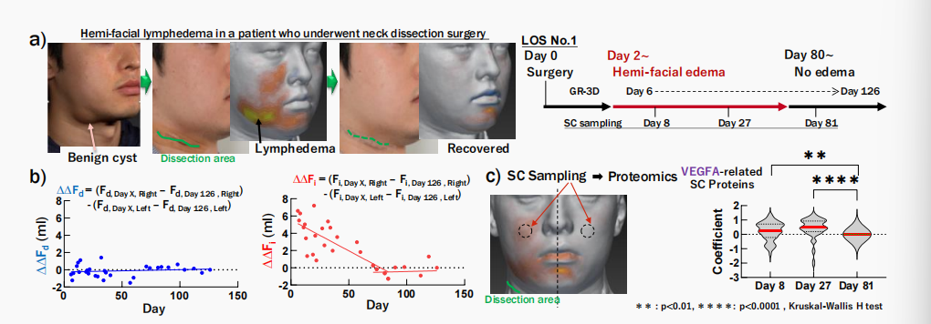 CIRS功效評(píng)價(jià),技術(shù)實(shí)踐,下垂,水腫,定量評(píng)估