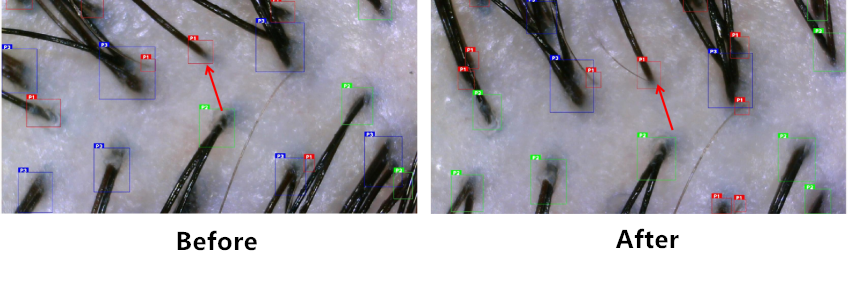 Scalp,health,Cosmetc,Efficacy,Evaluation