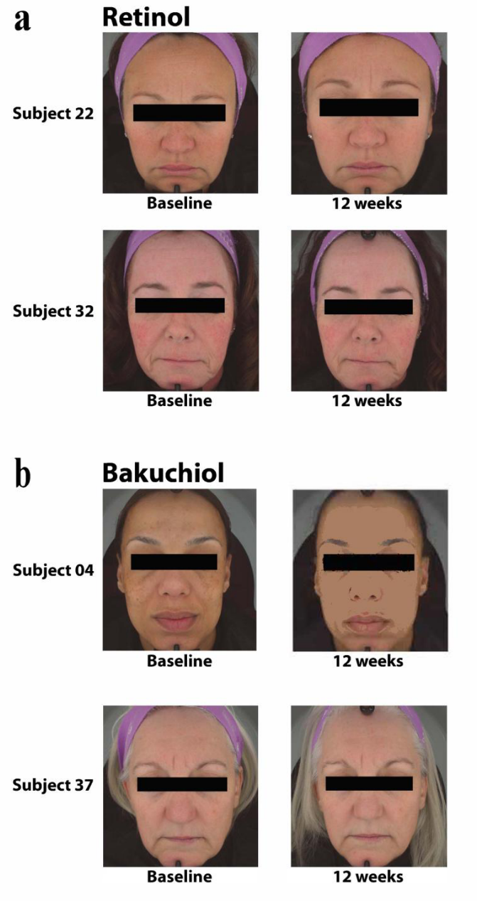 補骨脂酚,抗衰,視黃醇,修復(fù)皮膚
